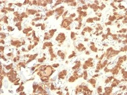 Cytokeratin 18 Antibody (Cocktail), Novus Biologicals 0.2mg; Unlabeled:Antibodies,